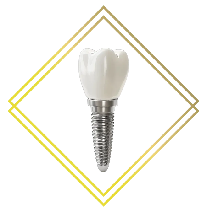 close up illustration of dental implant tooth